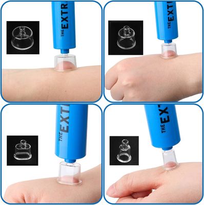 Portable EVA First Aid Kit with Zipper Closure and Four Extraction Cup Sizes for Snake Bites and Bee Stings